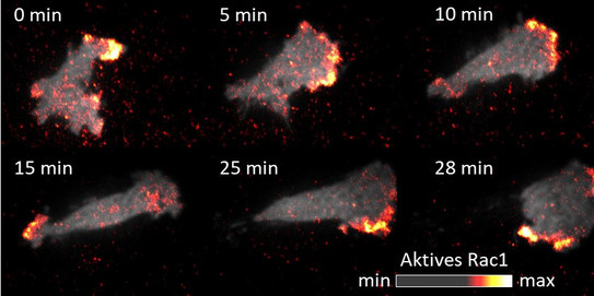 Microscopic image of a moving cancer cell at different times (minute 0 to minute 28)