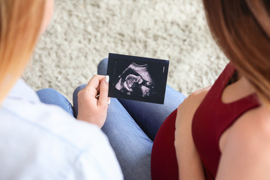 Das Foto zeigt zwei Frauen, die sich ein Ultraschallbild eines ungeborenen Kindes anschauen. Eine von ihnen ist schwanger.