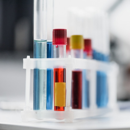 Ein Set Reagenzgläser mit verschiedenen roten und blauen Flüssigkeiten gefüllt.