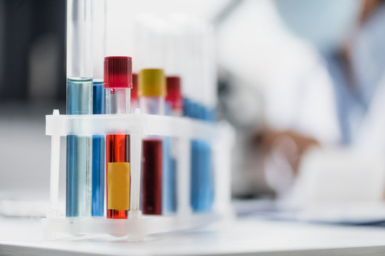 Set of test tubes A set of test tubes filled with various red and blue liquids.